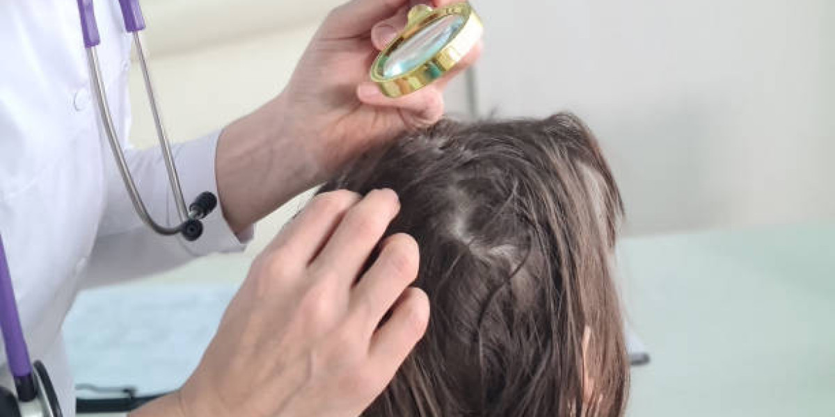 Exosomes Hair Therapy for Long-Term Hair Density Improvement