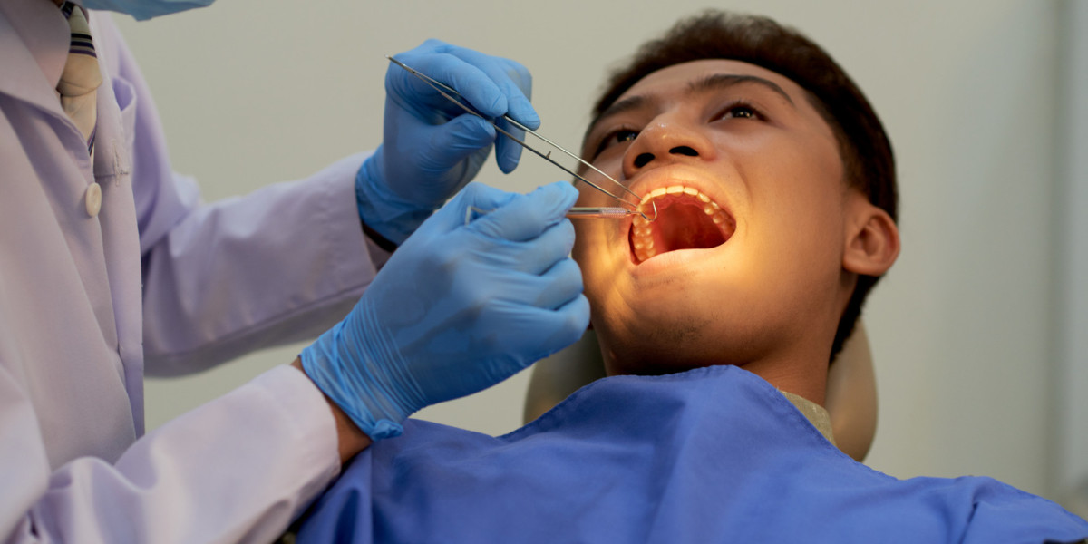 Full Mouth Rehabilitation in Borivali West: Restoring Function, Health, and Confidence