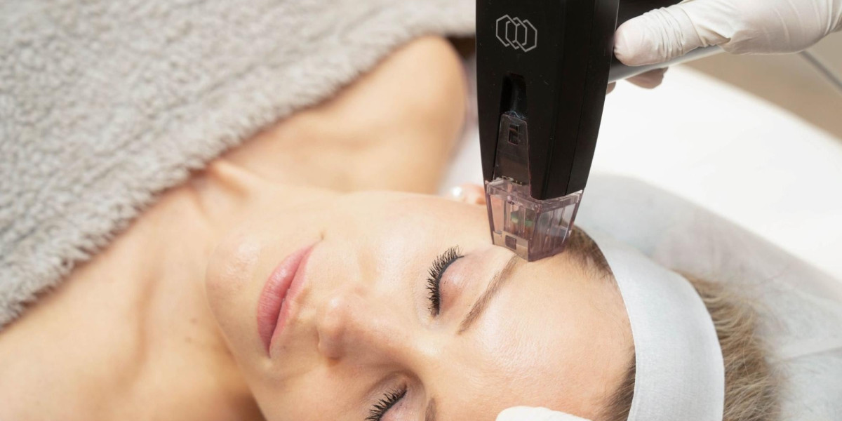 When To Get Morpheus8 Treatment?
