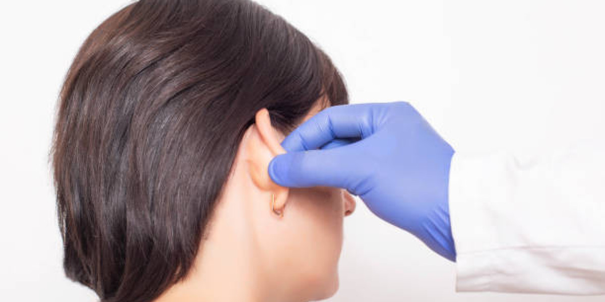 Ear Cosmetic Surgery for Beautiful Ear Contours